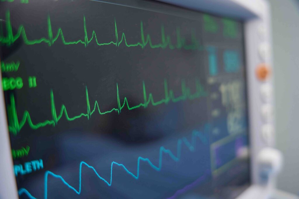 henrynurse pacu nurse part time rn ekg