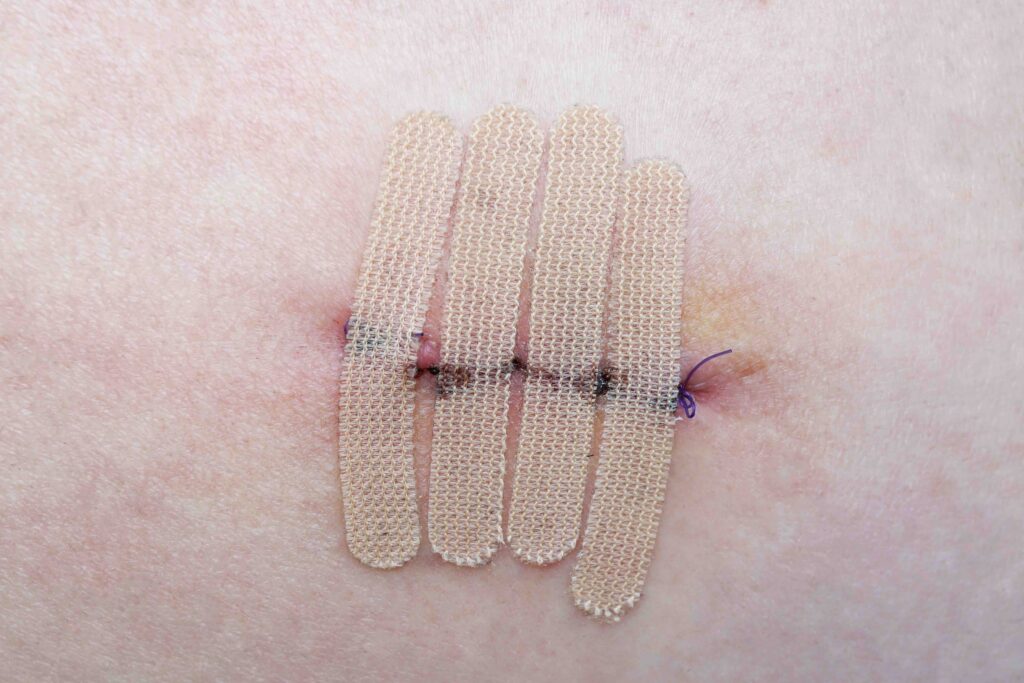 henrynurse pacu rn nurse part time nurse wound assessment
